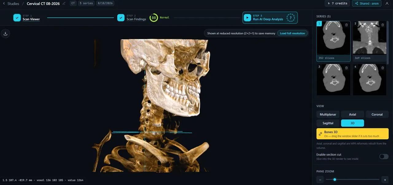 Read Your Scan screenshot
